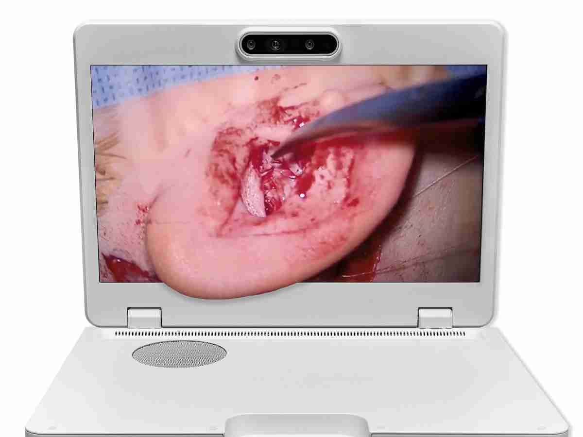 达擎之＂Heads-up 3D显微手术显示系统＂，，，整合4K裸眼3D显示及眼球追踪系统，，具备快速追踪人眼移动位置功能，，减轻医师长时间维持固定姿势的负担，，让医师能有更宽广清晰的3D立体视野及更舒适的姿势来执行手术。。。。